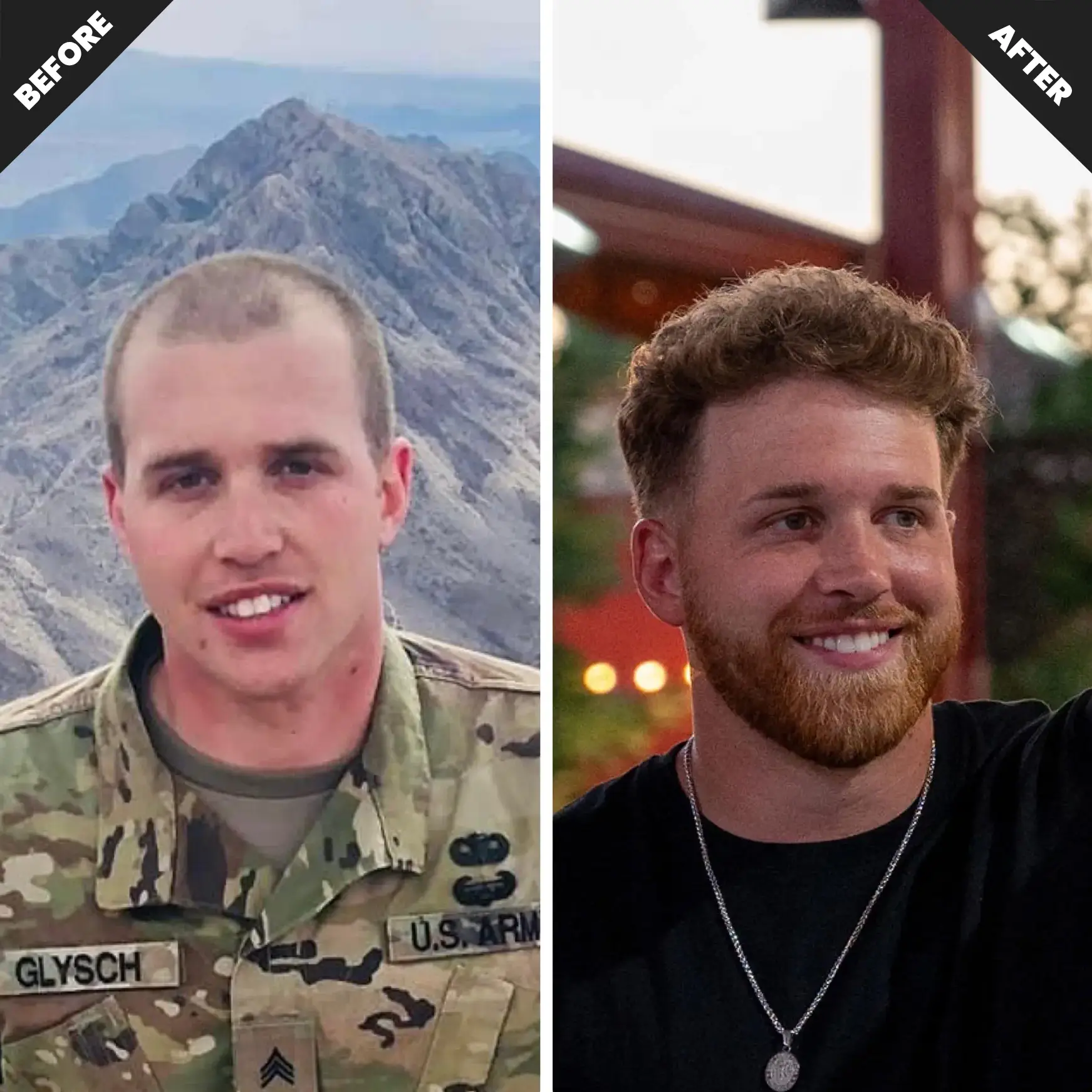 “Arron Glysch hair restoration routine steps” “Clinically guided hair regrowth therapy with ARSYNL Rx” “Before and after hair restoration results” “Finasteride and Minoxidil hair regrowth medications” “Microneedling for scalp stimulation and hair growth” “Medical-grade hair restoration topicals and serums” “Biotin-rich shampoo for hair follicle health” “Zinc and folic acid supporting healthy hair growth” “DHT-blocking medications for hair loss prevention” “Telemedicine hair restoration consultation with ARSYNL Rx” “Non-surgical hair restoration therapy for thicker, fuller hair” “Women’s and men’s hair loss medications online” “Telehealth hair regrowth program with clinically-backed formulas” veteran-founded telemedicine healthcare platform ARSYNL Rx founder Arron Glysch story purpose-driven telehealth company clinician-guided online medical care secure telemedicine platform in the United States non-surgical hair restoration journey confidence and mental resilience healthcare personalized telemedicine therapies evidence-based medical care online healthcare platform supporting long-term wellness discreet and confidential telehealth services medical science-driven wellness platform modern telemedicine brand with military roots healthcare built around confidence and privacy ARSYNL Rx mission-driven care philosophy clinician-led virtual healthcare experience veteran mental health support initiative telehealth platform focused on longevity and performance secure online healthcare consultation process trusted telemedicine provider nationwide